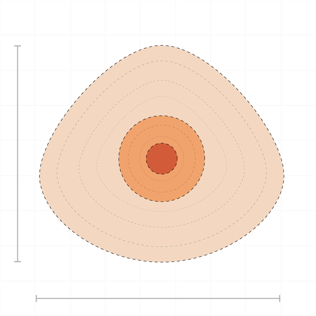 Diagram of silicone breast form